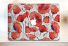 Etui Plastikowe na MacBook WCM2029